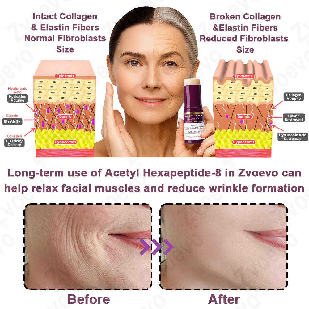 ✅ Official Store: Zvoevo® Calcium Collagen Repair Lip Balm 👨⚕️ FDA Certified (Targets wrinkles and fine lines, smooths nasolabial folds and neck wrinkles, reduces frown lines and crow's feet)