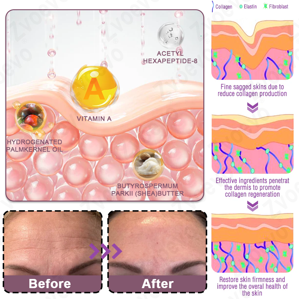 ✅ Official Store: Zvoevo® Calcium Collagen Repair Lip Balm 👨⚕️ FDA Certified (Targets wrinkles and fine lines, smooths nasolabial folds and neck wrinkles, reduces frown lines and crow's feet)