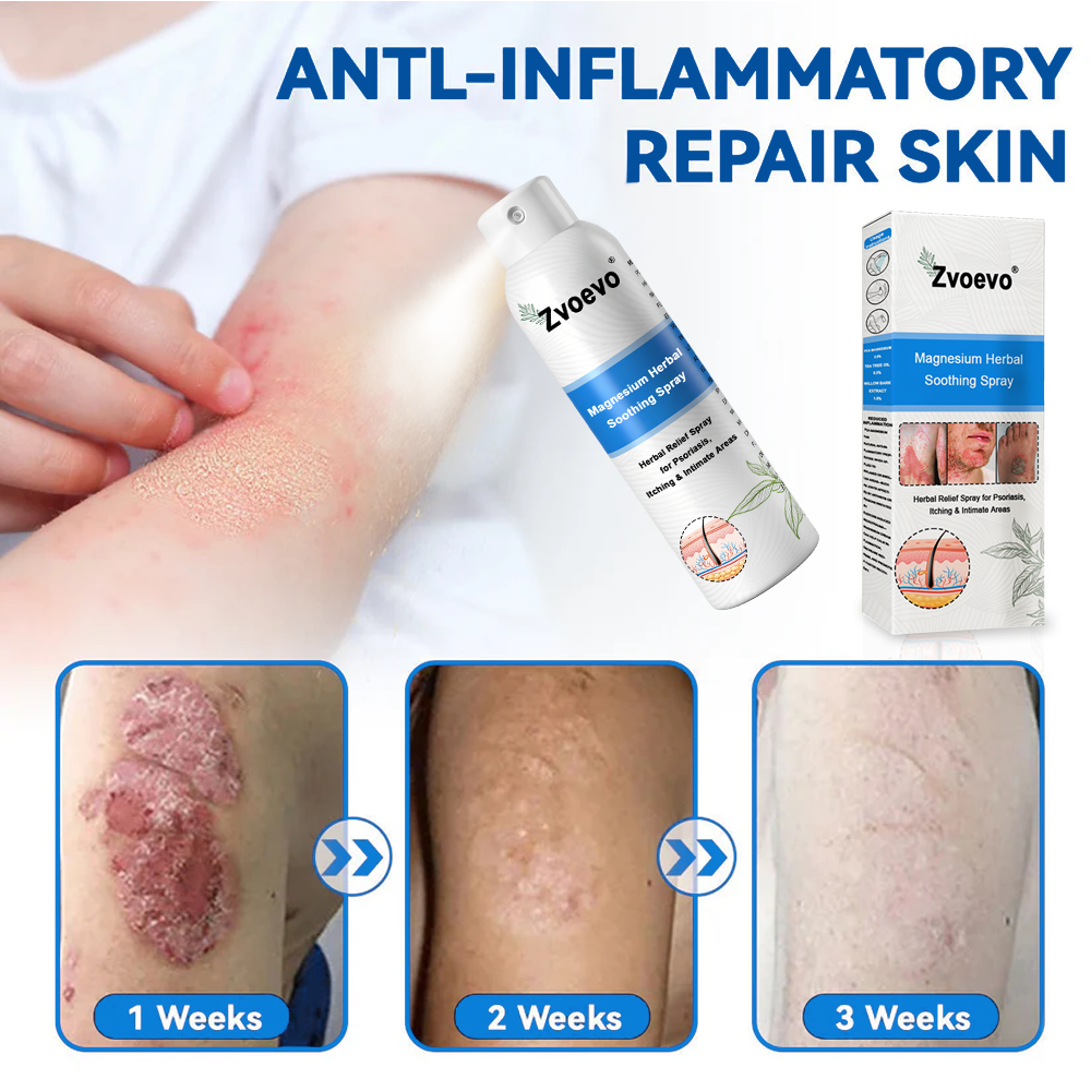 ✅ Official Store: Zvoevo® Magnesium Herbal Psoriasis Spray 👨⚕️ FDA Certified (for the treatment of psoriasis and eczema, improvement of bacterial infections in the genital area, treatment of acne and warts)