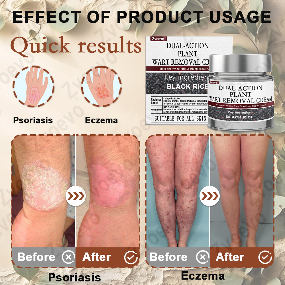 Zvoevo® Rice Bran Extract Cream 👨⚕️ FDA-Certified (For removing warts and skin growths, eliminating keratin buildup and skin hyperplasia, treating skin cancer, hyperpigmentation, and age spots)