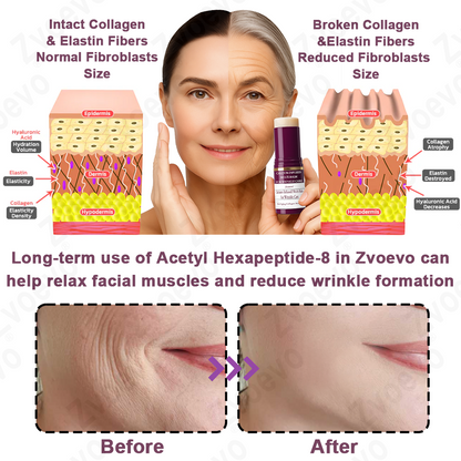 ✅ Official Store: Zvoevo® Calcium Collagen Repair Lip Balm ⚕️ FDA Certified (Targets wrinkles and fine lines, smooths nasolabial folds and neck wrinkles, reduces frown lines and crow's feet)