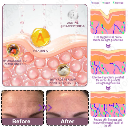 ✅ Official Store: Zvoevo® Calcium Collagen Repair Lip Balm ⚕️ FDA Certified (Targets wrinkles and fine lines, smooths nasolabial folds and neck wrinkles, reduces frown lines and crow's feet)