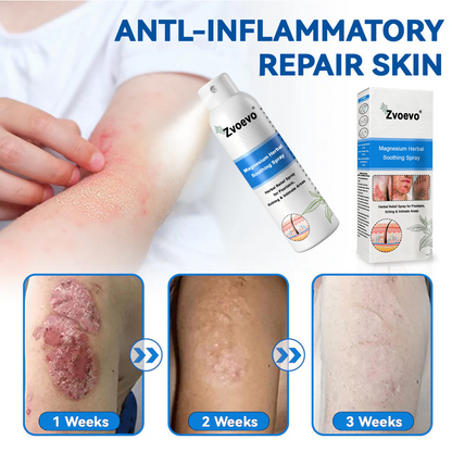 ✅ Official Store: Zvoevo® Magnesium Herbal Psoriasis Spray 👨‍⚕️ FDA Certified (Relieves Psoriasis and Eczema, Improves Bacterial Infections in the Genital Area, Treats Acne and Warts)