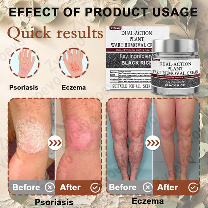 Zvoevo® Black Rice Skin Repair Essence Cream ⚕️ FDA Certified (Eliminates warts and skin tags, relieves psoriasis, improves keratin build-up and follicular keratinization, fades pigmentation, sun spots & age spots)